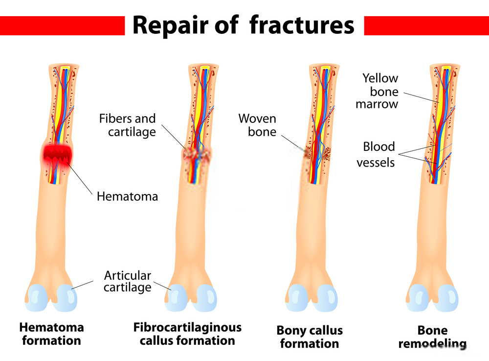 bone-disorders-can-be-dangerous-here-s-how-you-treat-them-fun-uploads